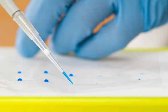 Hand holding a pipette with samples